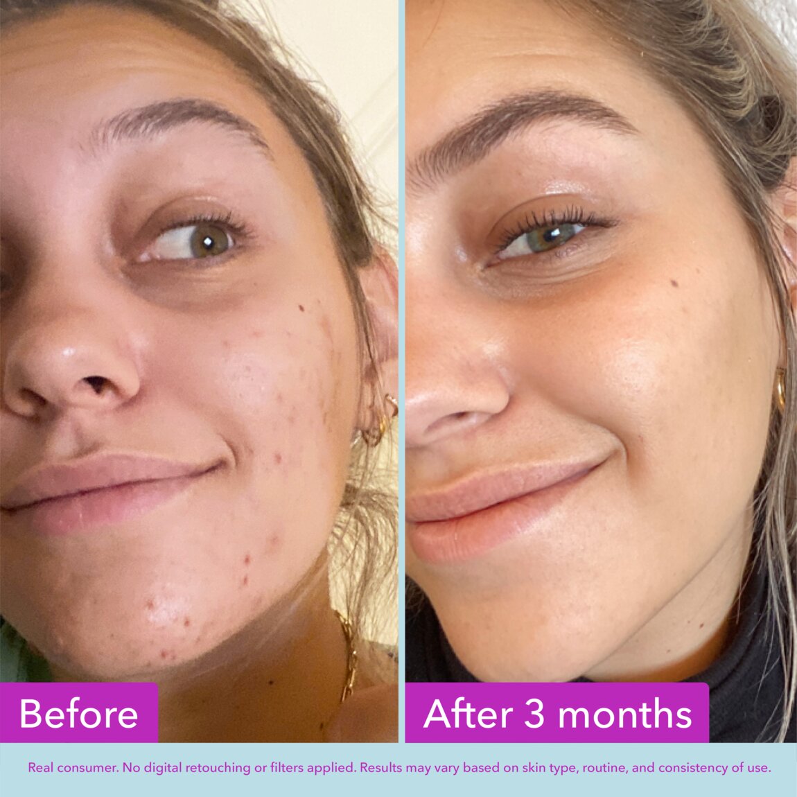 niacinamide-brightening-toner-n3 zb_p.jpg