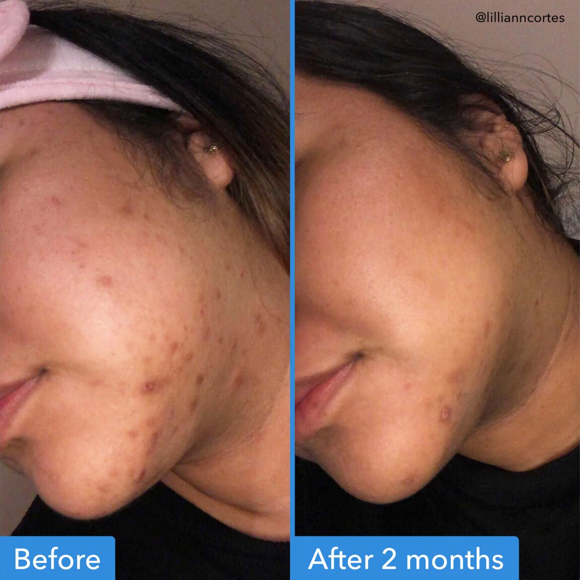 discoloration-correcting-serum-j1 zb_p.jpg