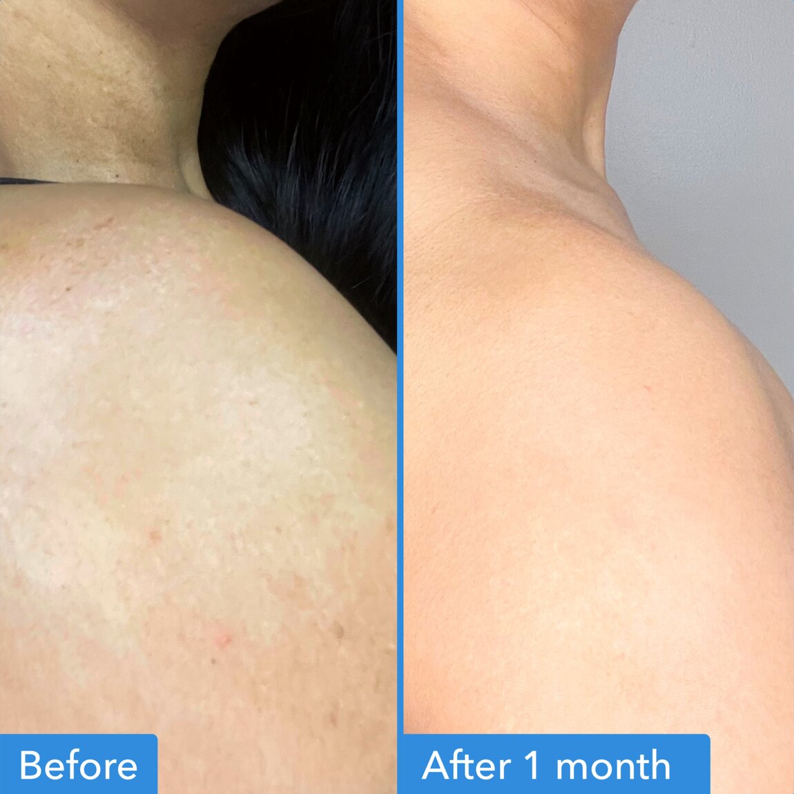 discoloration-correcting-body-treatment-e9 zb_p.jpg